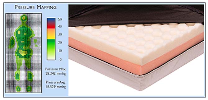 Relief-Care Pro® Surface Cut Technology Pressure Mapping