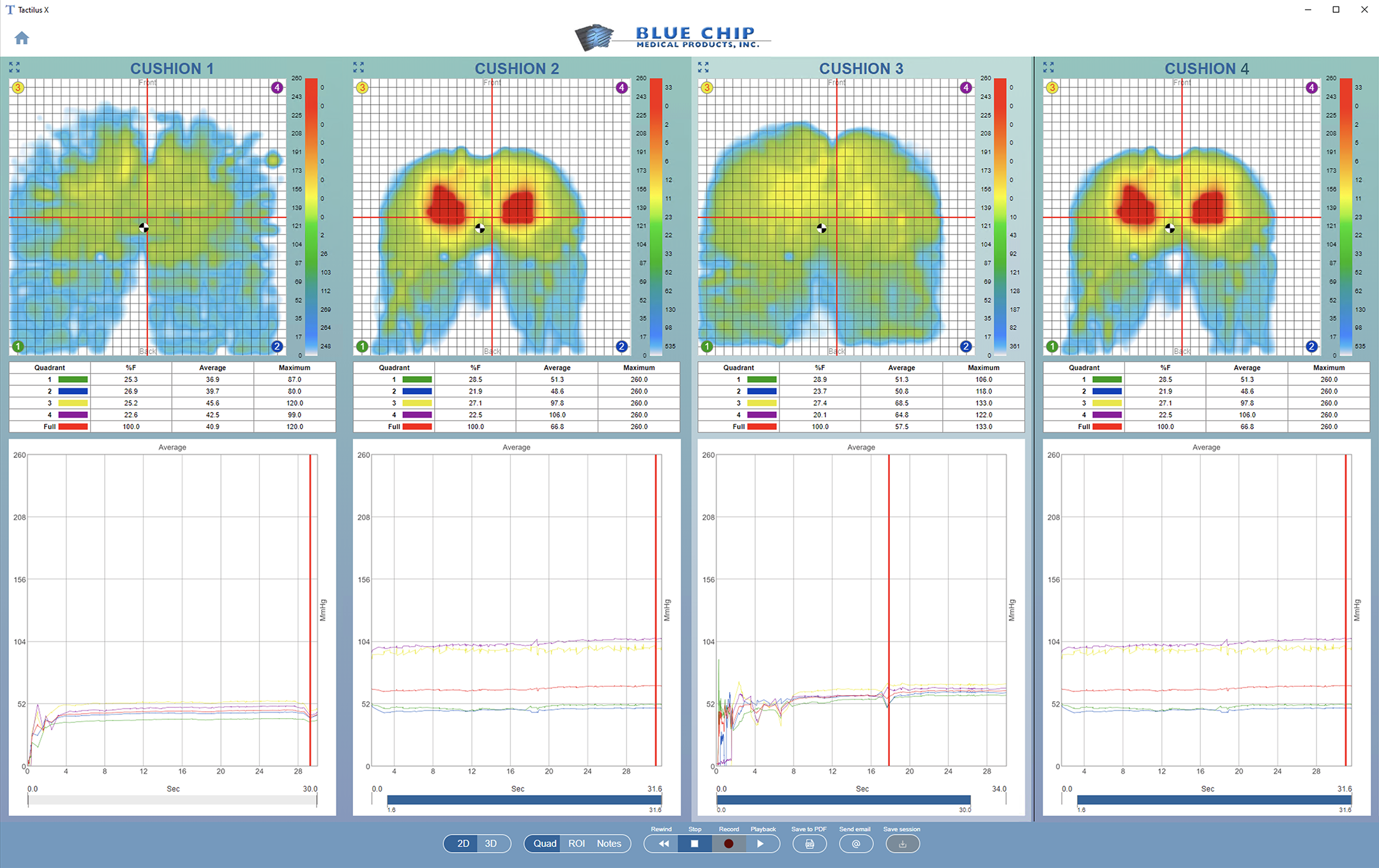 Side-by-side wheelchair cushion pressure comparison using Tactilus system