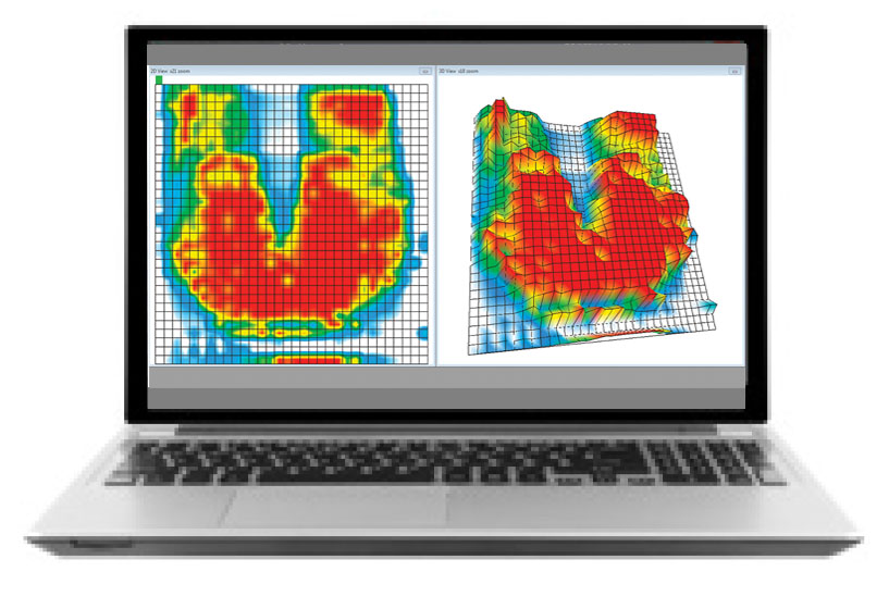Tactilus clinical software interface showing 2D and 3D pressure visualization